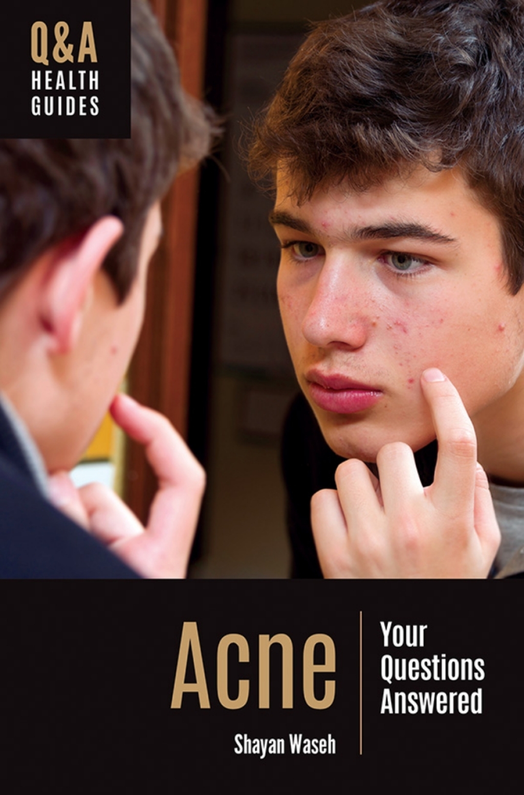 Acne Your Questions Answered