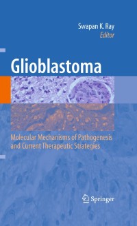 Cover image: Glioblastoma: 1st edition 9781441904096