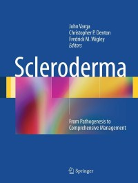 Cover image: Scleroderma 1st edition 9781441957733