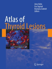 Cover image: Atlas of Thyroid Lesions 1st edition 9781441960092