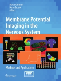 Immagine di copertina: Membrane Potential Imaging in the Nervous System 9781441965578