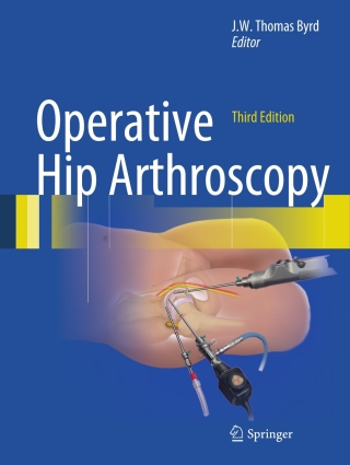 Imagen de portada: Operative Hip Arthroscopy 3rd edition 9781441979247