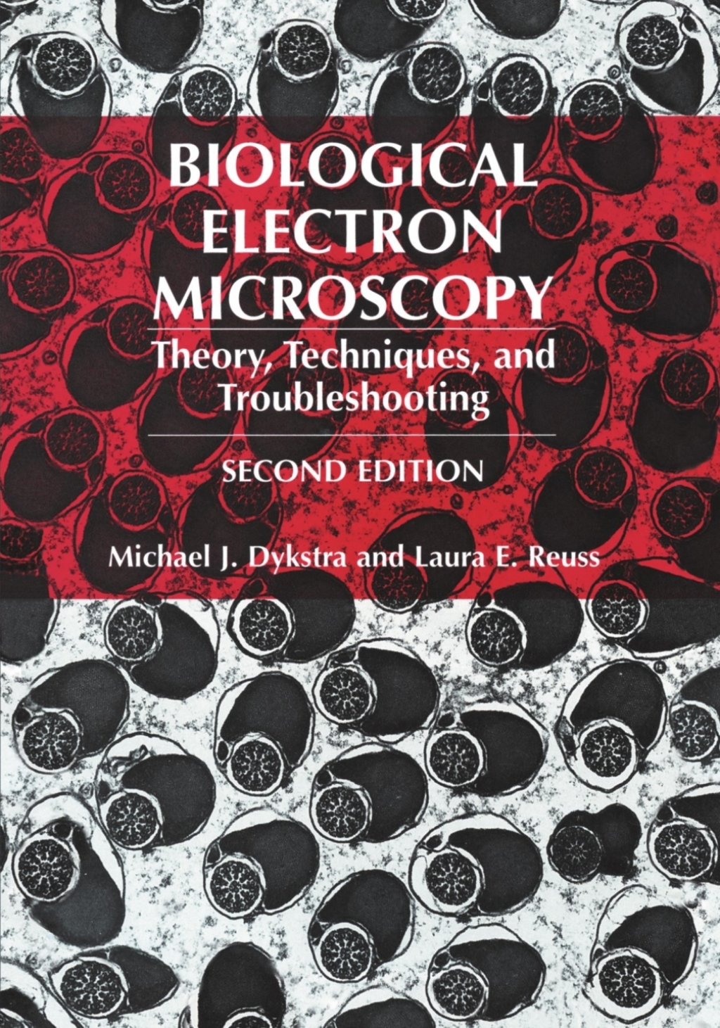 Biological Electron Microscopy Theory, Techniques, and Troubleshooting 2nd Edition