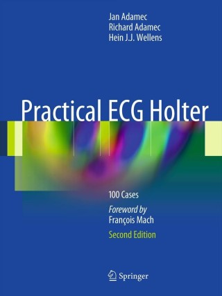 Imagen de portada: Practical ECG Holter 1st edition 9781441999542