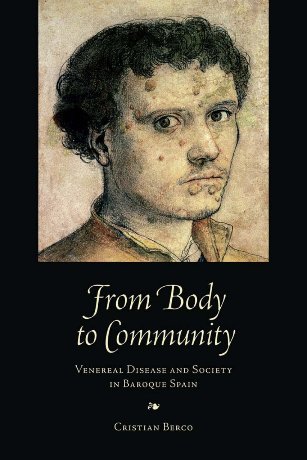 From Body to Community Venereal Disease and Society in Baroque Spain 1st Edition