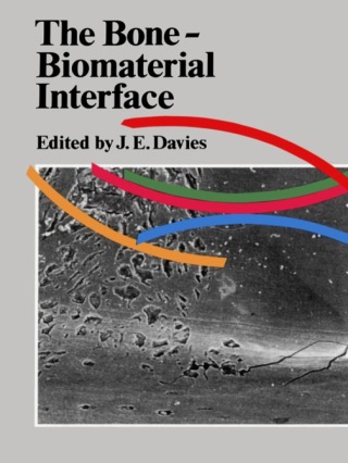 Cover image: Bone-Bio Material Interface 1st edition 9780802059413