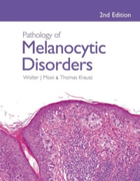 Imagen de portada: Pathology of Melanocytic Disorders 2ed 2nd edition 9780340809686