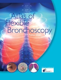 صورة الغلاف: Atlas of Flexible Bronchoscopy 1st edition 9781032477589
