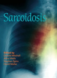 Cover image: Sarcoidosis 1st edition 9780367576769