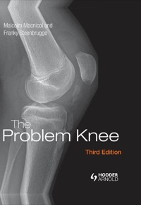 صورة الغلاف: The Problem Knee 3rd edition 9781138372467