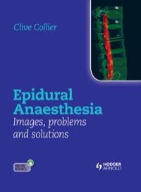Imagen de portada: Epidural Anaesthesia: Images, Problems and Solutions 1st edition 9781444156041