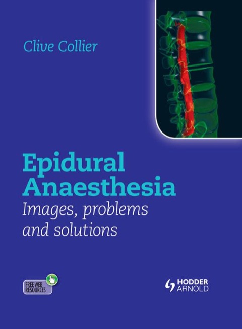 Epidural Anaesthesia: Images, Problems and Solutions, 1st Edition - FULL INSTANT DOWNLOAD | PDF DOCX EPUB
