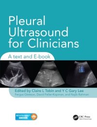 Omslagafbeelding: Pleural Ultrasound for Clinicians 1st edition 9781444166958