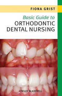 Omslagafbeelding: Basic Guide to Orthodontic Dental Nursing 1st edition 9781444333183