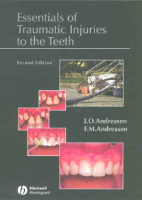 Cover image: Essentials of Traumatic Injuries to the Teeth: A Step-by-Step Treatment Guide 2nd edition 9780470698822