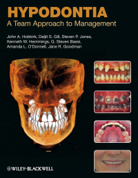 Cover image: Hypodontia: A Team Approach to Management 1st edition 9781405188593