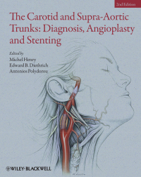 صورة الغلاف: The Carotid and Supra-Aortic Trunks: Diagnosis, Angioplasty and Stenting 1st edition 9781405198547