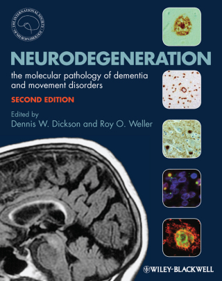 Imagen de portada: Neurodegeneration 2nd edition 9781405196932