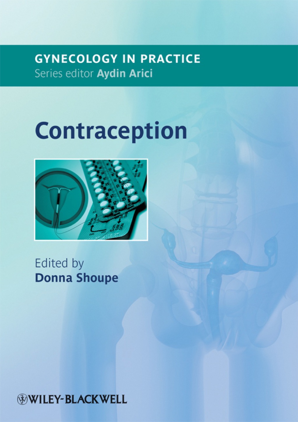 Contraception - 1st Edition (eBook)