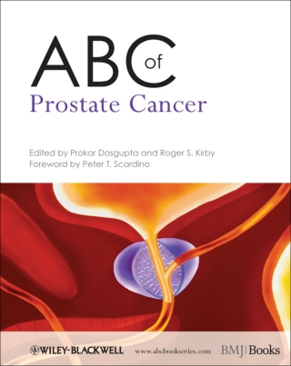 Cover image: ABC of Prostate Cancer 1st edition 9781444334371
