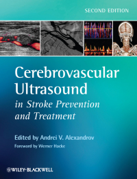 Cover image: Cerebrovascular Ultrasound in Stroke Prevention and Treatment 1st edition 9781405195768
