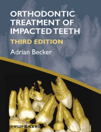 Imagen de portada: Orthodontic Treatment of Impacted Teeth 1st edition 9781444336757