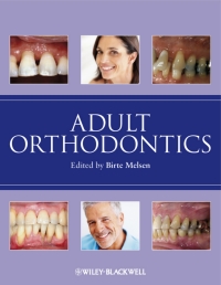 Cover image: Adult Orthodontics 1st edition 9781405136198