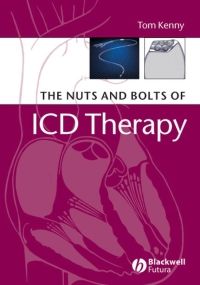 Cover image: The Nuts and Bolts of ICD Therapy 1st edition 9781405135115