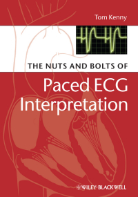 Cover image: The Nuts and bolts of Paced ECG Interpretation 1st edition 9781405184045