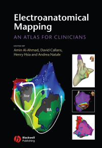 Cover image: Electroanatomical Mapping 1st edition 9781405157025