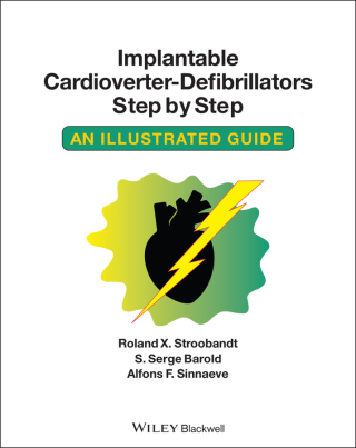Cover image: Implantable Cardioverter - Defibrillators Step by Step 1st edition 9781405186384