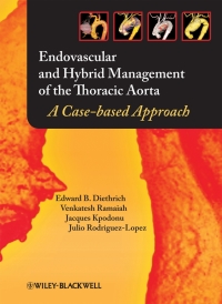 Imagen de portada: Endovascular and Hybrid Management of the Thoracic Aorta: A Case-based Approach 1st edition 9781405175357