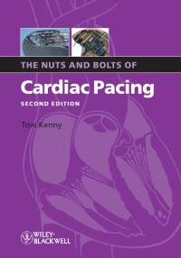 صورة الغلاف: The Nuts and Bolts of Cardiac Pacing 2nd edition 9781405184038