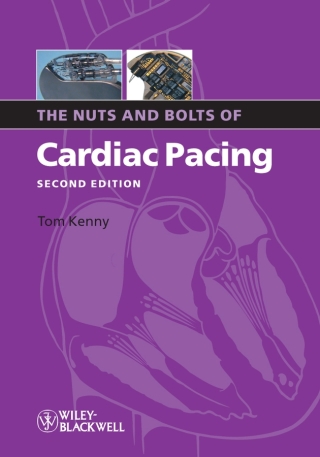 Cover image: The Nuts and Bolts of Cardiac Pacing 2nd edition 9781405184038