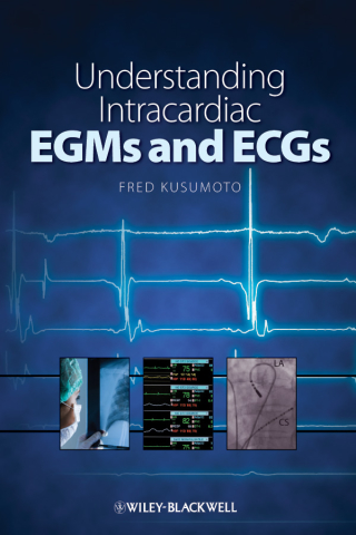 Cover image: Understanding Intracardiac EGMs and ECGs 1st edition 9781405184106