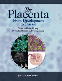 Titelbild: The Placenta: From Development to Disease 1st edition 9781444333664