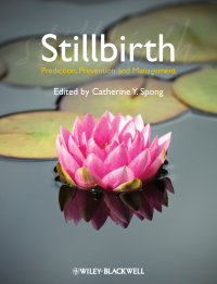 Imagen de portada: Stillbirth 1st edition 9781444337068