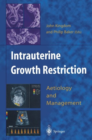 Titelbild: Intrauterine Growth Restriction 1st edition 9781852331917