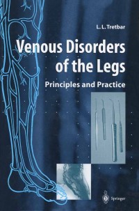 Cover image: Venous Disorders of the Legs 9781852330071