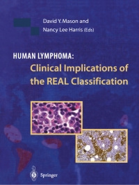 Imagen de portada: Human Lymphoma: Clinical Implications of the REAL Classification 1st edition 9781852331290