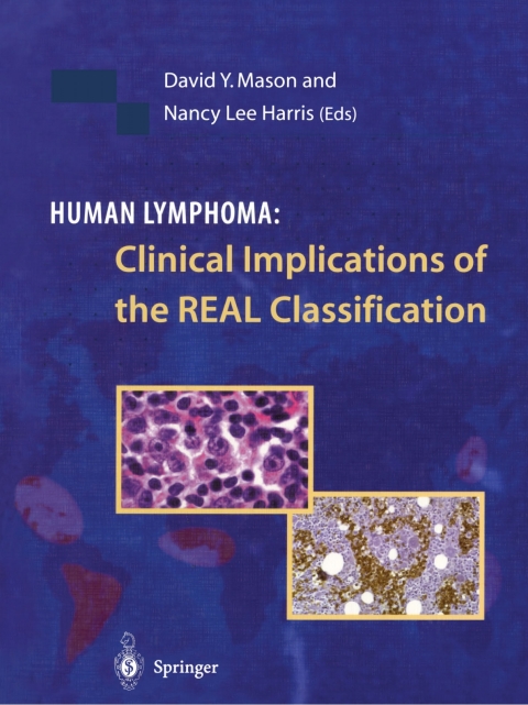 Human Lymphoma: Clinical Implications of the REAL Classification, 1st Edition - FULL INSTANT DOWNLOAD | PDF DOCX EPUB