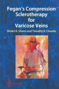 Omslagafbeelding: Fegan’s Compression Sclerotherapy for Varicose Veins 1st edition 9781852337124
