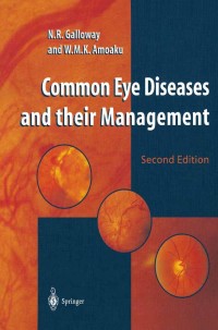 Immagine di copertina: Common Eye Diseases and their Management 2nd edition 9781852330507
