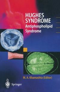 صورة الغلاف: Hughes Syndrome 1st edition 9781852332327