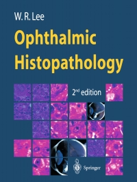 Cover image: Ophthalmic Histopathology 2nd edition 9781852330491