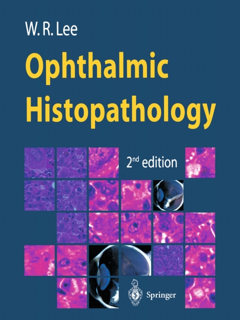 Ophthalmic Histopathology, 2nd Edition - FULL INSTANT DOWNLOAD | PDF DOCX EPUB