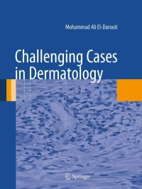 表紙画像: Challenging Cases in Dermatology 9781447142485