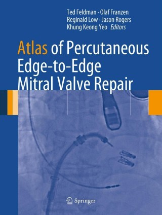 Cover image: Atlas of Percutaneous Edge-to-Edge Mitral Valve Repair 9781447142935