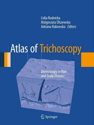 Cover image: Atlas of Trichoscopy 1st edition 9781447144861