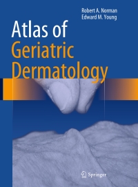 صورة الغلاف: Atlas of Geriatric Dermatology 9781447145783